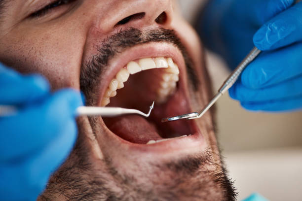 Best Emergency Treatment for Dental Infections or Abscesses in Rockwood, VA