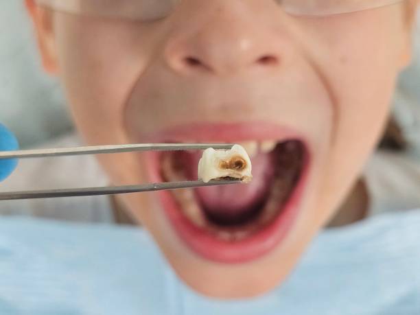 Best Pediatric Emergency Dentist in Rockwood, VA