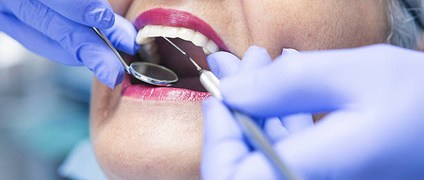 Best Emergency Dental Care for Broken or Chipped Teeth in Rockwood, VA